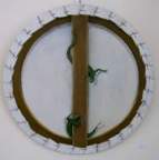 cancer du sein infiltrant